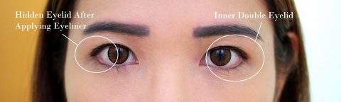 Dst double shop eyelid surgery